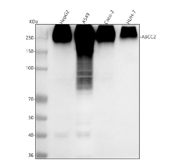 1 - Anti-MRP2 ABCC2 Rabbit Monoclonal Antibody ABO13557