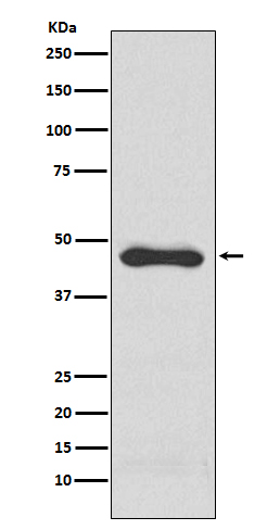 1 - Anti-PAI1 Rabbit Monoclonal Antibody ABO13564