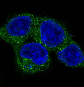 3 - Anti-ULK1/Atg1 Rabbit Monoclonal Antibody ABO13565