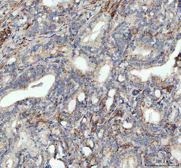 2 - Anti-ULK1/Atg1 Rabbit Monoclonal Antibody ABO13565