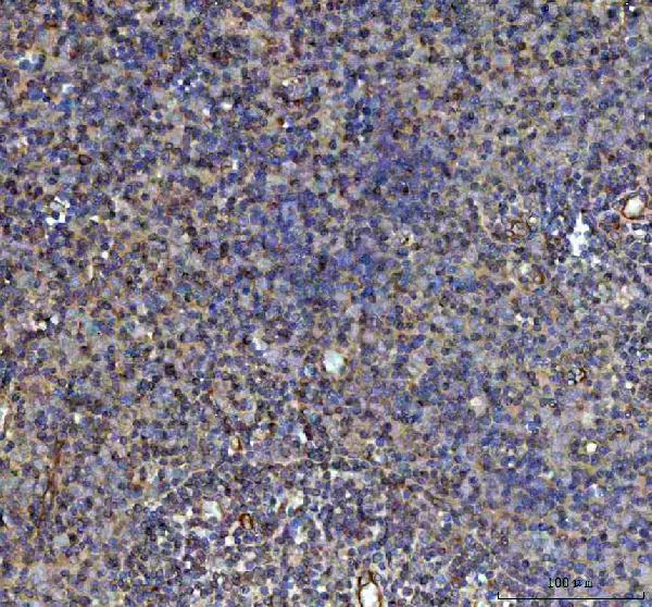 2 - Anti-ULK1/Atg1 Rabbit Monoclonal Antibody ABO13565