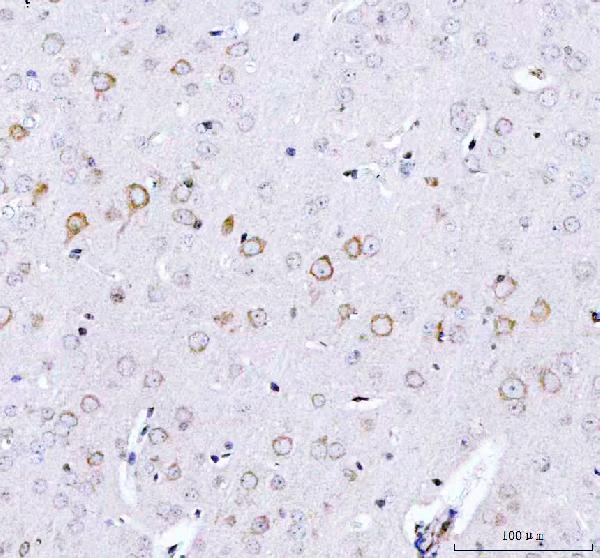 2 - Anti-ULK1/Atg1 Rabbit Monoclonal Antibody ABO13565