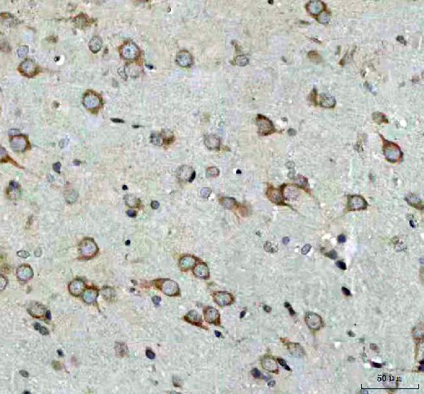 2 - Anti-ULK1/Atg1 Rabbit Monoclonal Antibody ABO13565