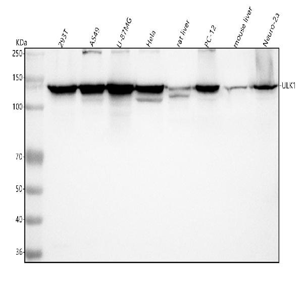 1 - Anti-ULK1/Atg1 Rabbit Monoclonal Antibody ABO13565