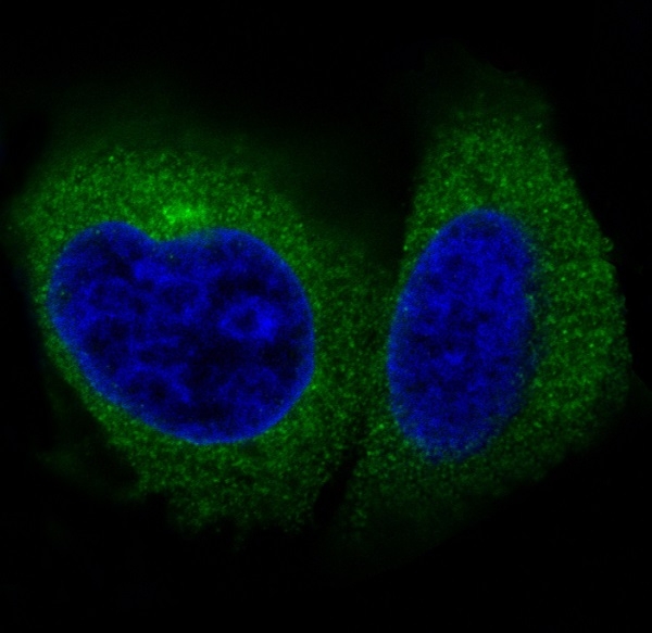 1 - Anti-Actin ACTA1 Rabbit Monoclonal Antibody ABO13566