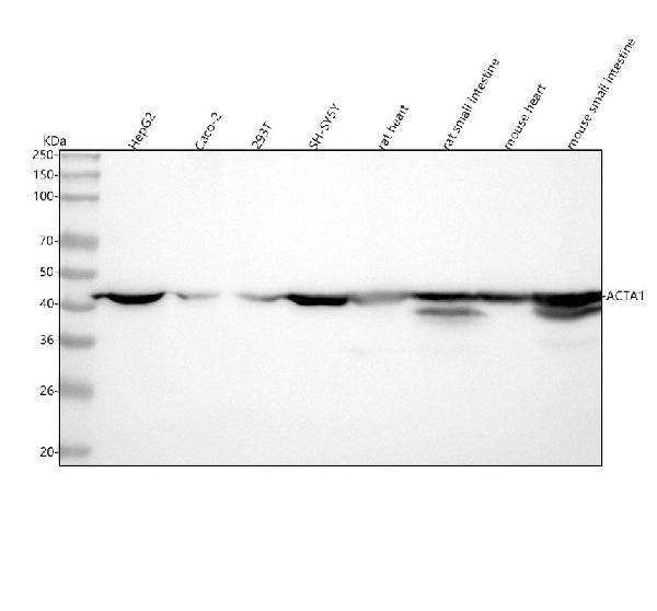 1 - Anti-Actin ACTA1 Rabbit Monoclonal Antibody ABO13566