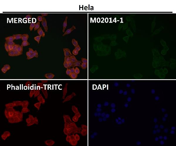 1 - Anti-Actin ACTA1 Rabbit Monoclonal Antibody ABO13566