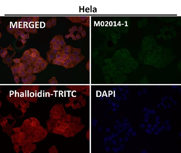 1 - Anti-Actin ACTA1 Rabbit Monoclonal Antibody ABO13566