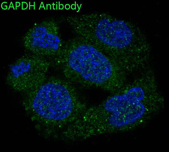 3 - Anti-GAPDH Rabbit Monoclonal Antibody ABO13567