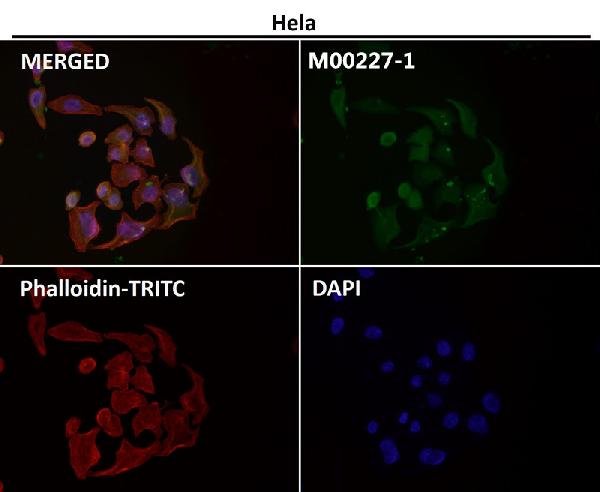 1 - Anti-GAPDH Rabbit Monoclonal Antibody ABO13567
