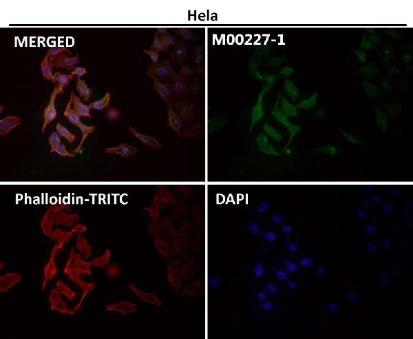 1 - Anti-GAPDH Rabbit Monoclonal Antibody ABO13567