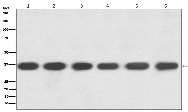 1 - Anti-GAPDH Rabbit Monoclonal Antibody ABO13568