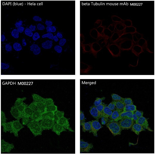 3 - Anti-GAPDH Rabbit Monoclonal Antibody ABO13568