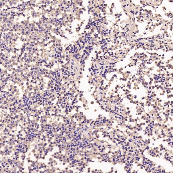 2 - Anti-GAPDH Rabbit Monoclonal Antibody ABO13568