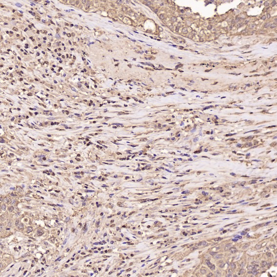 2 - Anti-GAPDH Rabbit Monoclonal Antibody ABO13568