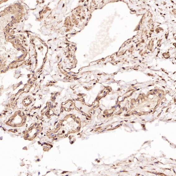 2 - Anti-GAPDH Rabbit Monoclonal Antibody ABO13568