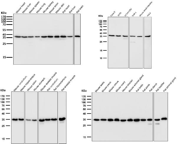 1 - Anti-GAPDH Rabbit Monoclonal Antibody ABO13568