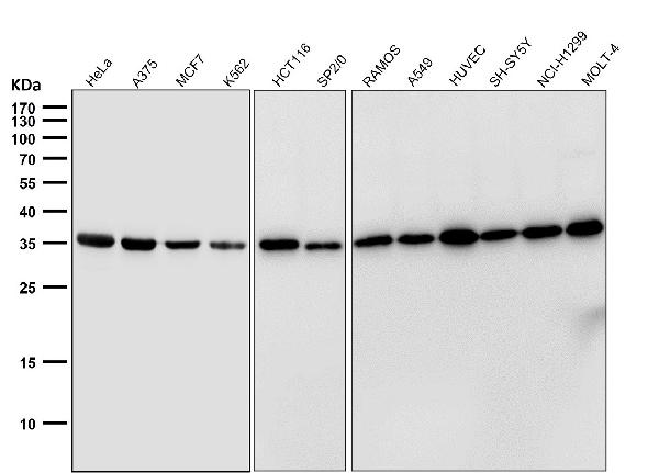 1 - Anti-GAPDH Rabbit Monoclonal Antibody ABO13568
