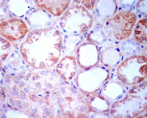 2 - Anti-TGFBI/Beta Ig H3 Rabbit Monoclonal Antibody ABO13569