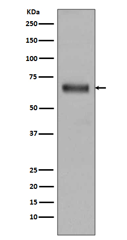 1 - Anti-TGFBI/Beta Ig H3 Rabbit Monoclonal Antibody ABO13569