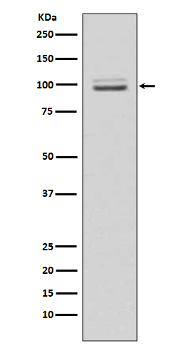 1 - Anti-MKLP1 KIF23 Rabbit Monoclonal Antibody ABO13570