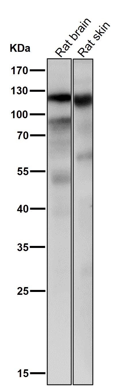 1 - Anti-MKLP1 KIF23 Rabbit Monoclonal Antibody ABO13570