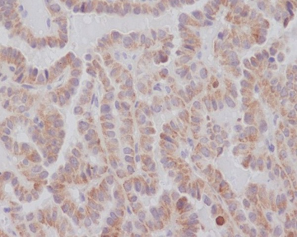 2 - Anti-KIFC1 Rabbit Monoclonal Antibody ABO13571