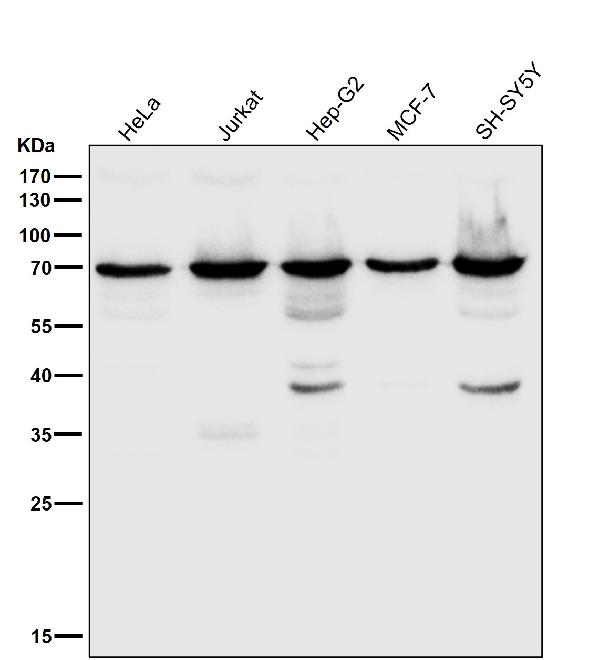 1 - Anti-KIFC1 Rabbit Monoclonal Antibody ABO13571
