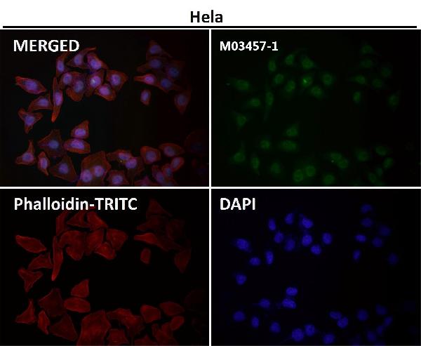 1 - Anti-RNF20 Rabbit Monoclonal Antibody ABO13572