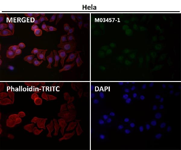 1 - Anti-RNF20 Rabbit Monoclonal Antibody ABO13572