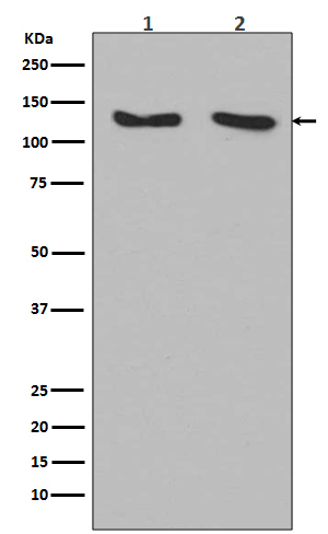 1 - Anti-RNF20 Rabbit Monoclonal Antibody ABO13572