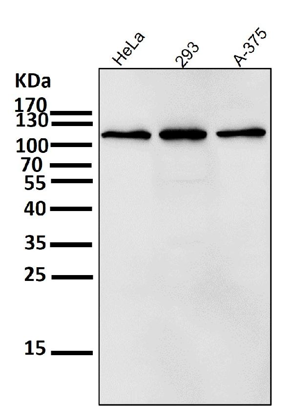 1 - Anti-RNF20 Rabbit Monoclonal Antibody ABO13572