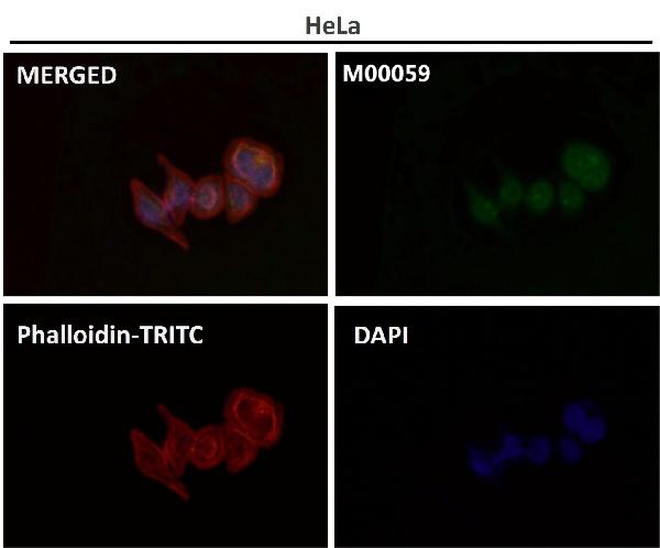 1 - Anti-Smad3 Rabbit Monoclonal Antibody ABO13573