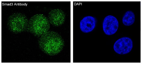 3 - Anti-Smad3 Rabbit Monoclonal Antibody ABO13573