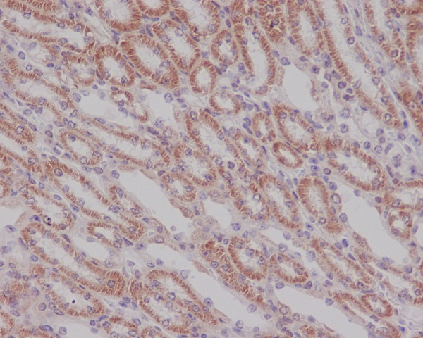 2 - Anti-Smad3 Rabbit Monoclonal Antibody ABO13573