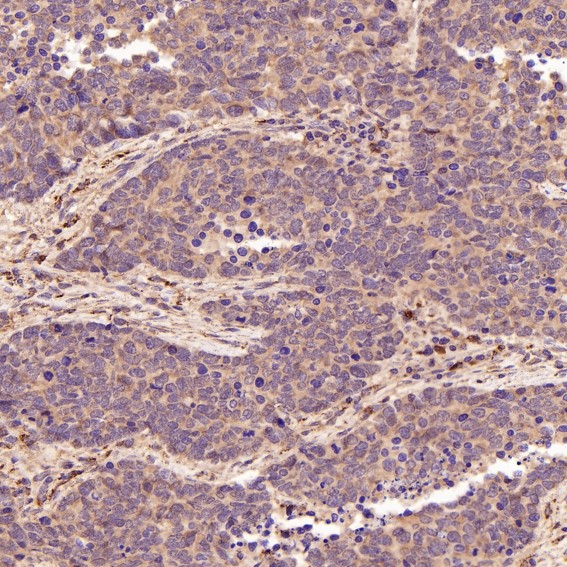 2 - Anti-Smad3 Rabbit Monoclonal Antibody ABO13573
