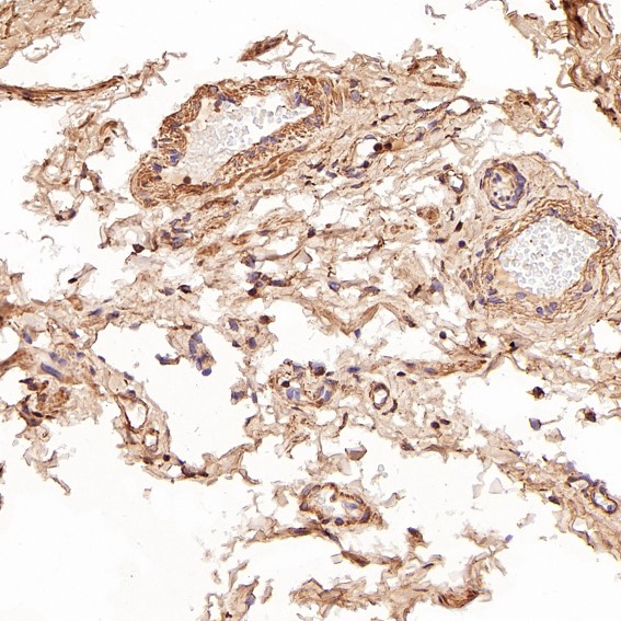 2 - Anti-Smad3 Rabbit Monoclonal Antibody ABO13573