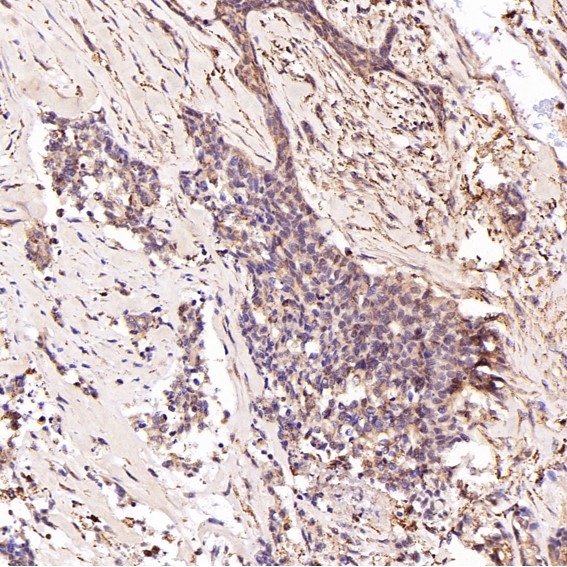 2 - Anti-Smad3 Rabbit Monoclonal Antibody ABO13573