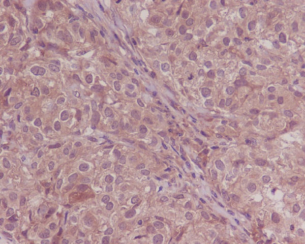 2 - Anti-Smad4 Rabbit Monoclonal Antibody ABO13574