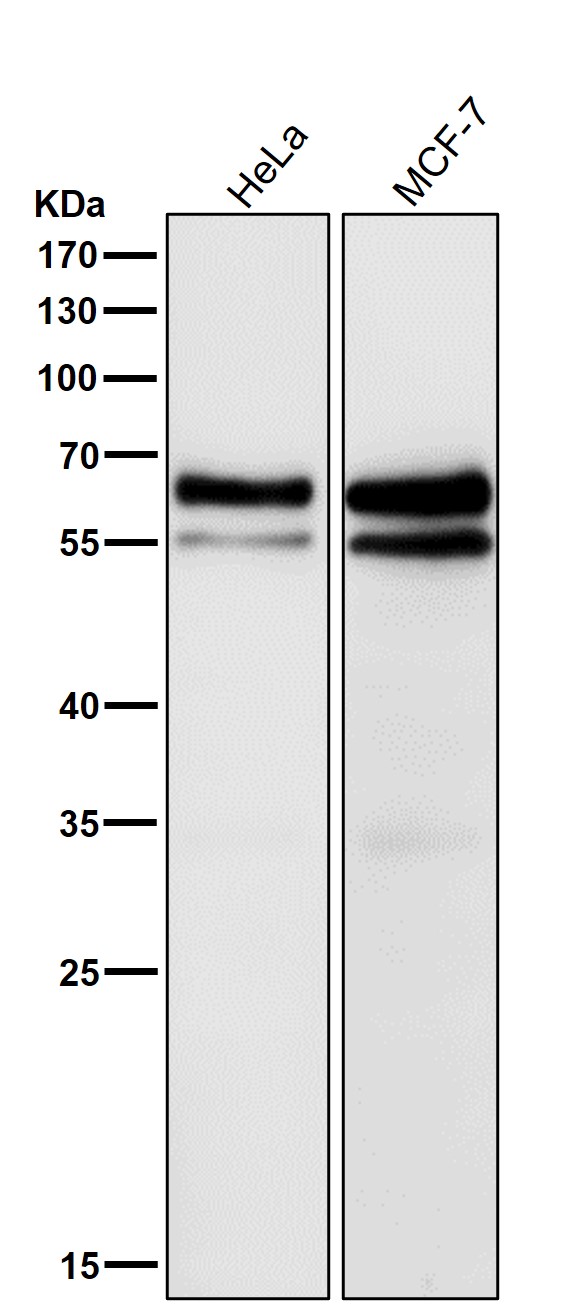 1 - Anti-Smad4 Rabbit Monoclonal Antibody ABO13574