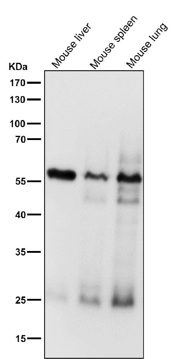 1 - Anti-Smad4 Rabbit Monoclonal Antibody ABO13574