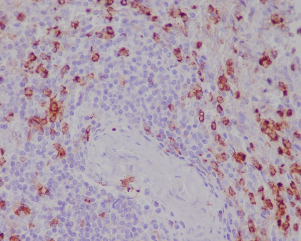2 - Anti-CD11b ITGAM Rabbit Monoclonal Antibody ABO13576