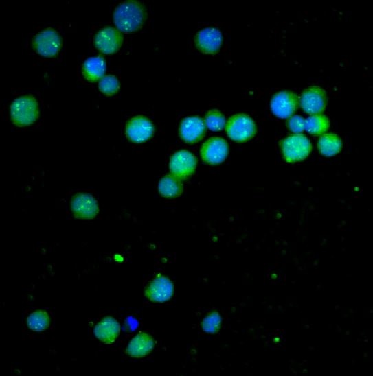 3 - Anti-Bcl-2 Rabbit Monoclonal Antibody ABO13577