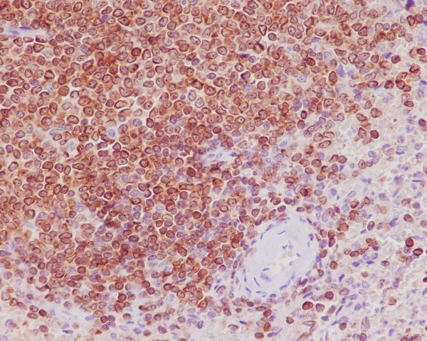 2 - Anti-Bcl-2 Rabbit Monoclonal Antibody ABO13577