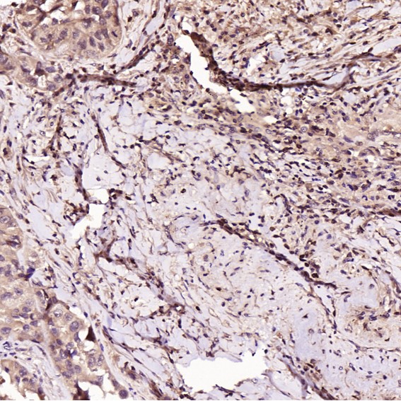 2 - Anti-Bcl-2 Rabbit Monoclonal Antibody ABO13577