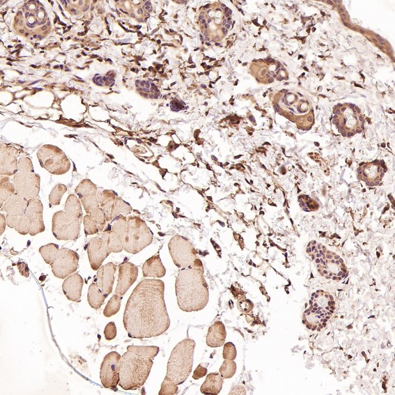 2 - Anti-Bcl-2 Rabbit Monoclonal Antibody ABO13577