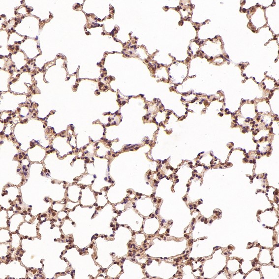 2 - Anti-Bcl-2 Rabbit Monoclonal Antibody ABO13577