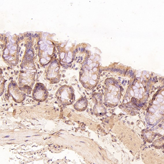 2 - Anti-Bcl-2 Rabbit Monoclonal Antibody ABO13577