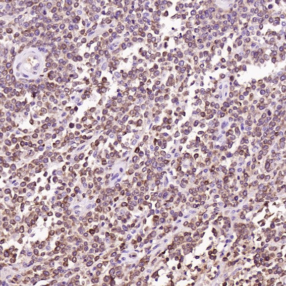 2 - Anti-Bcl-2 Rabbit Monoclonal Antibody ABO13577