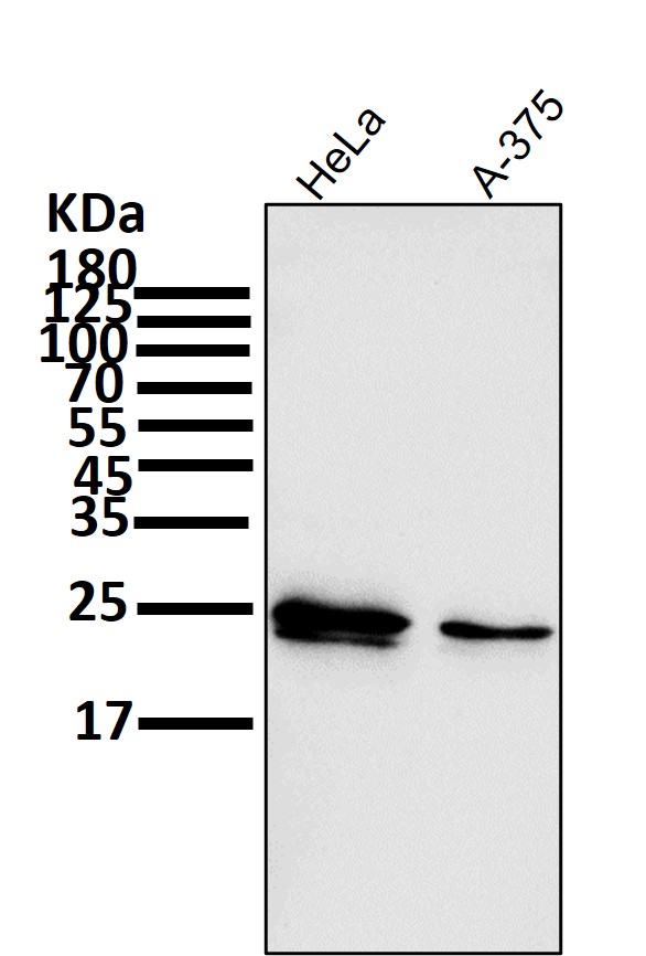1 - Anti-Bcl-2 Rabbit Monoclonal Antibody ABO13577
